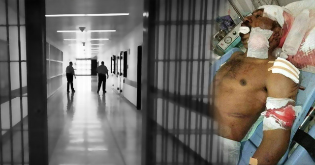 Maikel Ilintamon (25), who was beaten by Abepura (Abe) Class IIA Lapas (LP) officers, Jayapura, Papua (24/04).